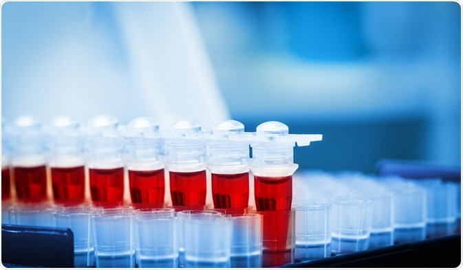 Procalicitonin is a biomarker for lung inflammation, commonly seen in respiratory tract infections.